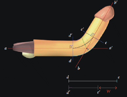 Pene Curvo - Andrologo Napoli